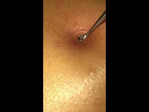 Nice little pop on the shoulder
