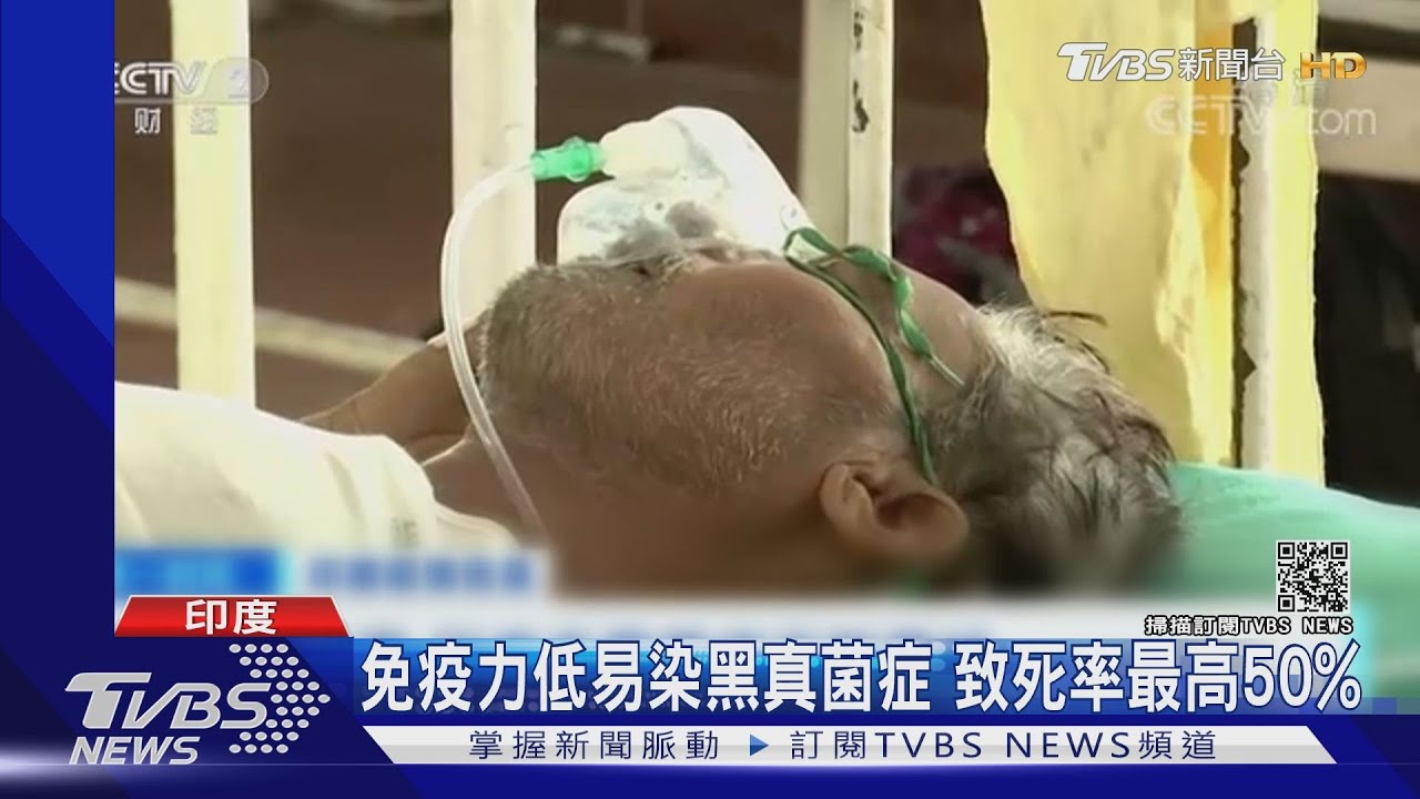 新冠病毒威脅不減 印度還出現「黑、白真菌」疫情