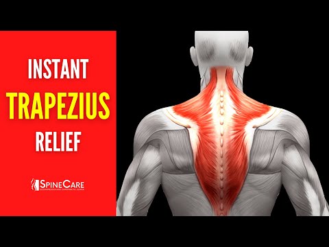 How to Fix Upper Trapezius Pain FOR GOOD