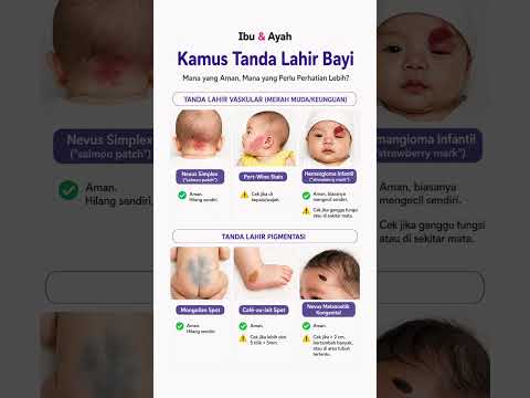 Tanda Lahir Bayi Mana yang Aman dan Mana yang Perlu Dicek ke Dokter? Ini Panduannya #ibudanayah