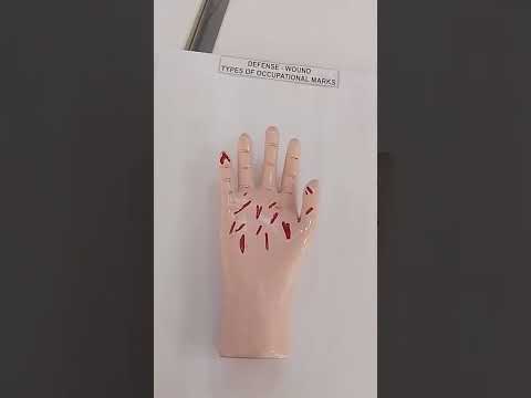 Forensic Model Type Of Occupational Marks