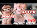 BYTE ALIGNERS REVIEW Progress Byte Aligners Before After