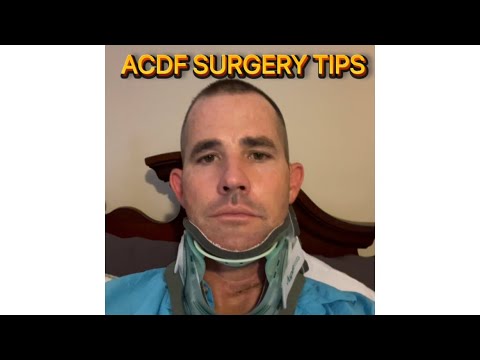 ACDF Fusion Surgery: Tips I wish I knew before surgery