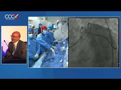 LIVE CASE #3, #4 and #5 - Calcified Bifurcation and CTO Lesions