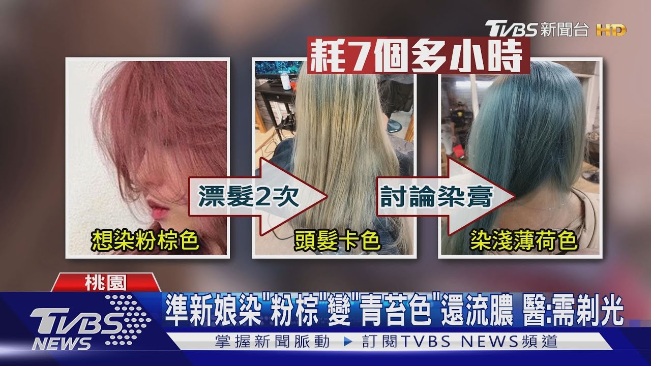 準新娘染「粉棕」變「青苔色」還流膿 醫:需剃光