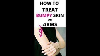 How to Treat Bumpy Skin on Arms #shorts