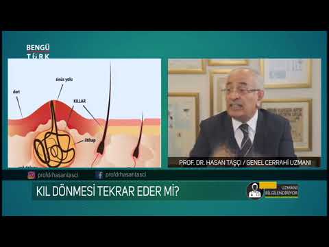 Kıl Dönmesi Tekrar Eder mi? Prof. Dr. Hasan Taşçı bilgilendiriyor...