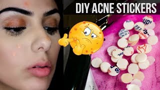 bandaids for acne - THE BEST OVERNIGHT PIMPLE SPOT TREATMENT HANDS DOWN | DIY