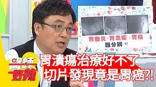 胃潰瘍治療好不了，3個月後切片竟是胃癌？！【醫師好辣】20200203 part2 EP886 賈蔚 陳保仁