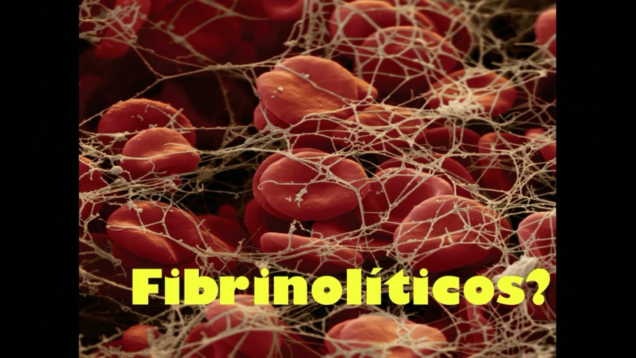 Trombolisis en stroke #FOAMed #MUE #ChileEM