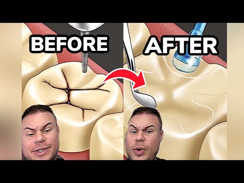 Orthodontist Reacts! Molar Tooth Restoration