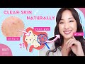 How the Food You Eat Affects Your Skin & Gut 🍞🍦🍉 (ft. Mandi Nyambi) - Beauty Within How the Food You Eat Affects Your Skin & Gut 🍞🍦🍉 (ft. Mandi Nyambi)