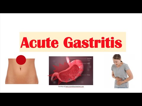 Acute Gastritis (Stomach Inflammation) | Causes, Signs & Symptoms, Diagnosis, Treatment