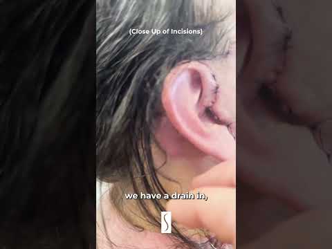 Leong Plastic Surgery NYC