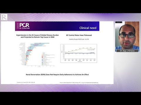 PCR e-Course 2020: Crossover Results From The RADIANCE-HTN SOLO Trial — Dr Ajay J Kirtane