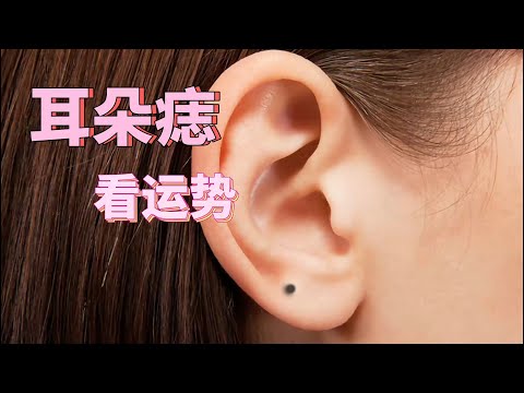 耳朵 痣 面相