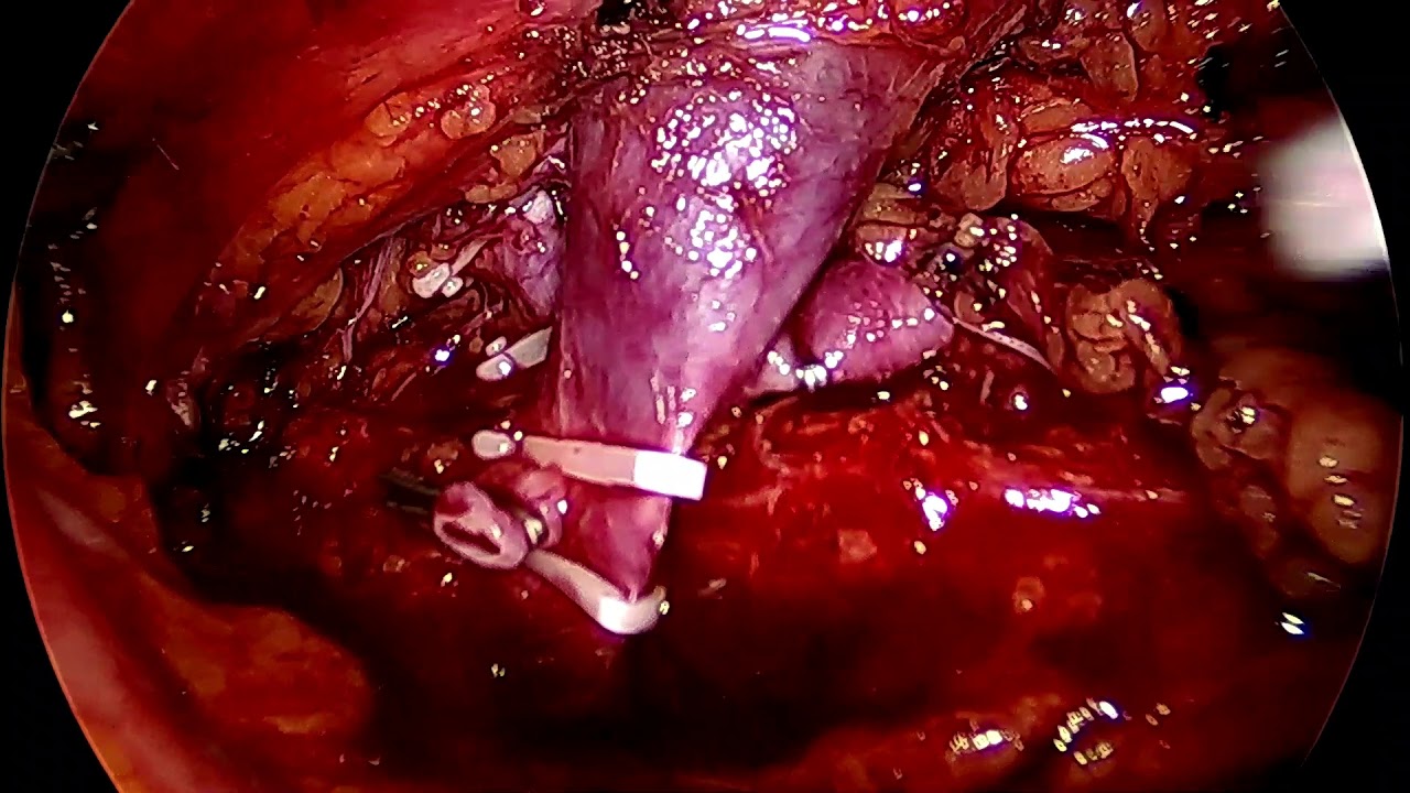 Humberto Romo Valdes-32