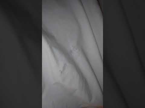 DAYS INN HAS BEDBUGS