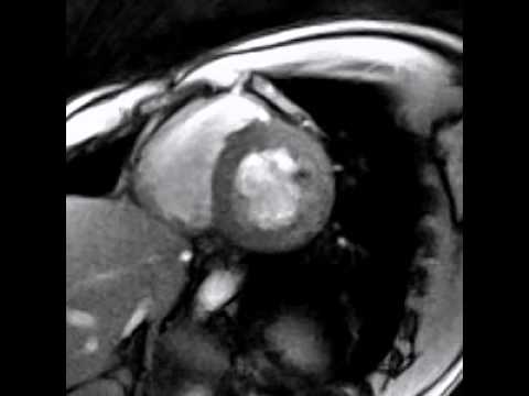 Mittel aus Osteochondrose Knie Krampfadern des Knies
