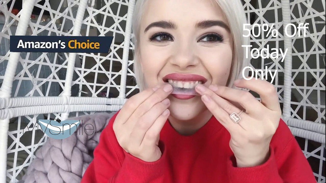 Shocking results MySmile Advanced Teeth Whitening Strips