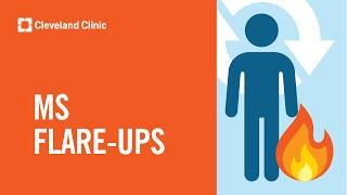 How To Manage MS Flare-Ups