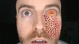 10 BIZARRE DISEASES Science Can't Explain! (Part 2)