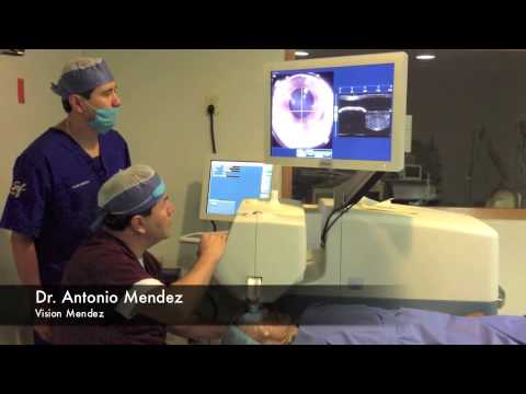 Laser Assisted Cataract Surgery (Docking)