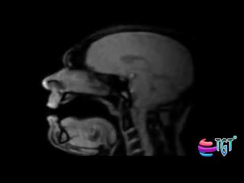 Tenor MRI