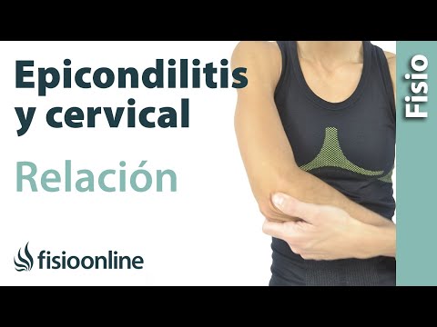 Epicondilitis y su relación con la zona cervical o las vértebras cervicales