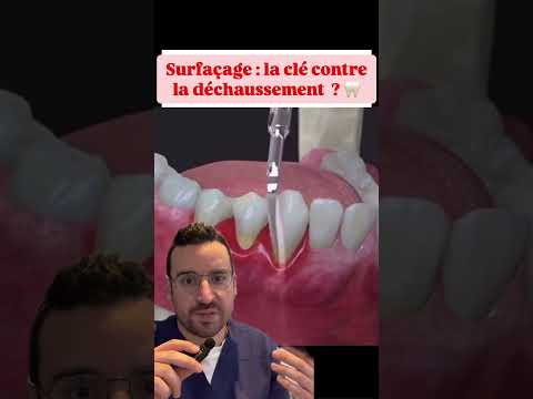 SURFACING: the key to preventing dental loosening?
