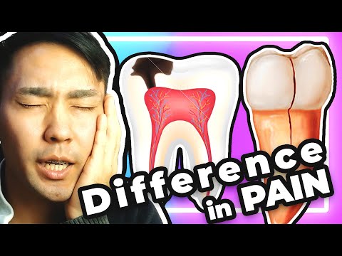 Cracked Tooth and Cavity Tooth, They Both Hurts but What is the Difference