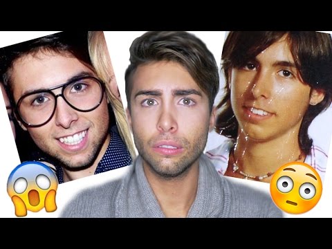 Rassegne delle medicine di decolorazione su una faccia Unguento di faccia da macchie scure