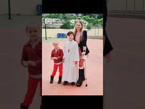 Fractura de Tibia y peroné