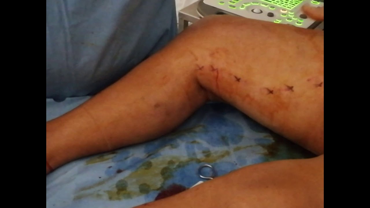 Jorge Eduardo Martinez Cachon-26