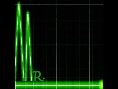 Mr.Ligne vs Romica Puceanu - Electro Manéa