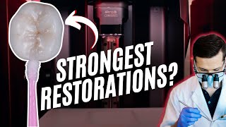 Unlock ROI & Precision with 3D Printed Restorations | Case Bites