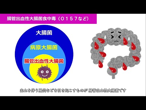 食中毒啓発ファイル Ｆｉｌｅ6 腸管出血性大腸菌食中毒（Ｏ１５７など）