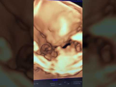 Guillermo Carrera Franco-9
