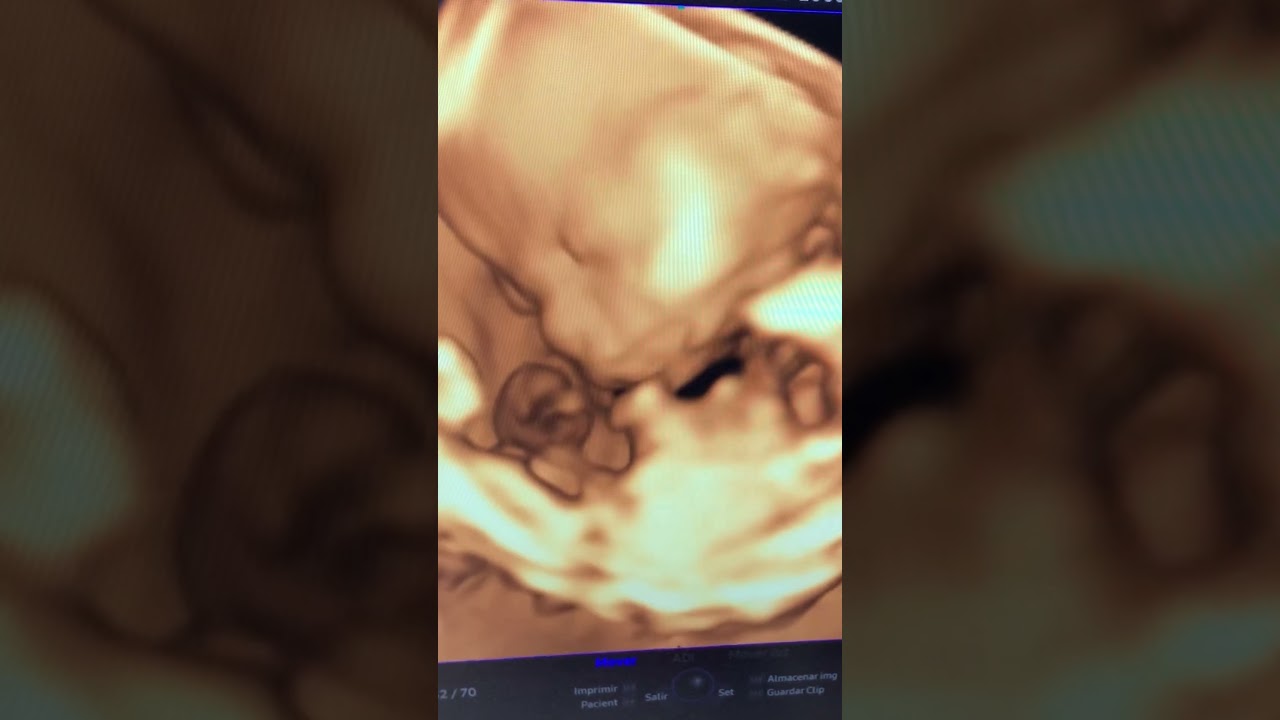 Guillermo Carrera Franco-9