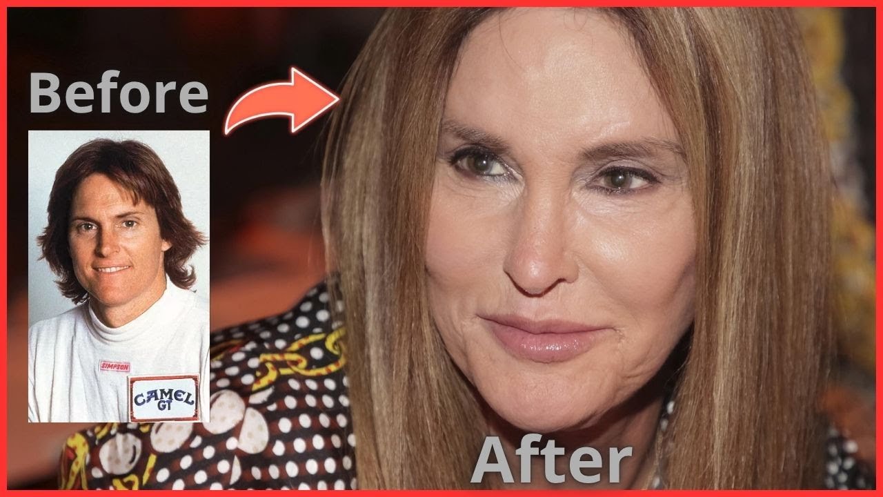 15 Shocking Male Stars’ Plastic Surgery Transformations! | Hollywood Then & Now