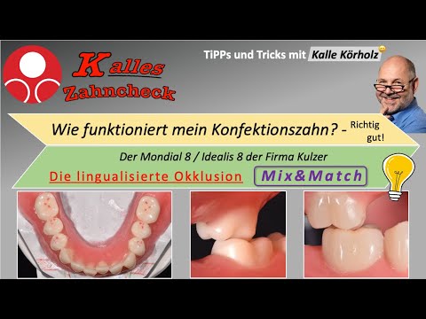 Kalles Zahncheck: Die lingualisierte Okklusion zwischen dem Mondial 8 und Idealis 8 der Firma Kulzer