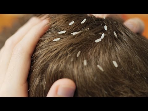 Il lyambliya che sono sintomi come trattare Come tratta lyambliya al bambino