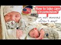 How To Take Care Circumcision On Newborn Baby Sheryl Squad