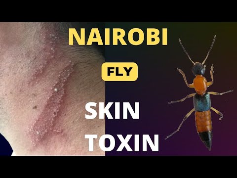 Nairobi fly - the mystery