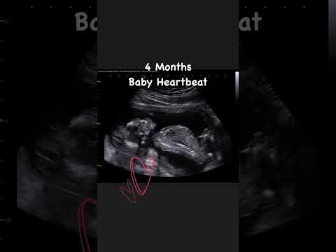 4 Months Baby Heartbeat 💙 #jerbearimaging #athomeultrasound #heartbeat #babyontheway #ultrasound