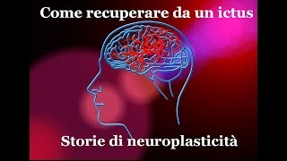 Storie di neuroplasticità: come recuperare da un ictus (# 2)