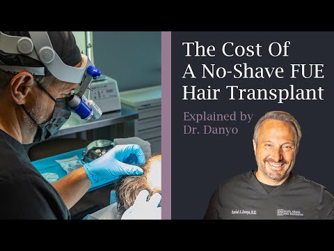 The Cost Of A No Shave FUE Hair Transplant