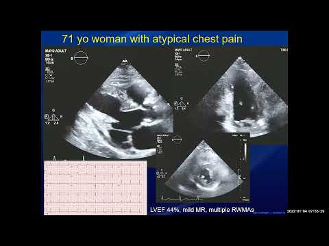 GMT20220104 124410 Recording 1920x1080 1