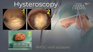 RPOC with small scissors (5Fr)