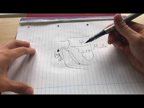 Anatomy of the infratemporal fossa